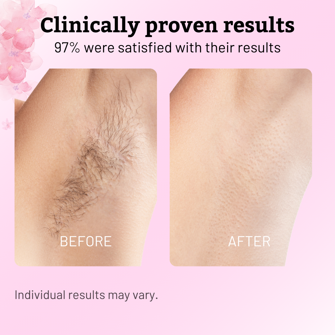 Hair Removal Oil